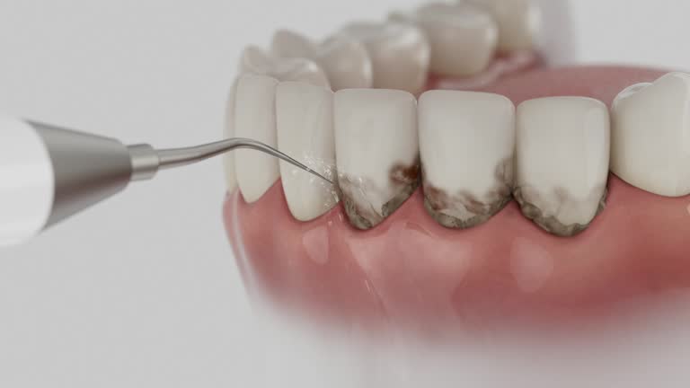 Trusted Teeth Cleaning And Checkup service in New Milford, NJ - Dentist Open Now